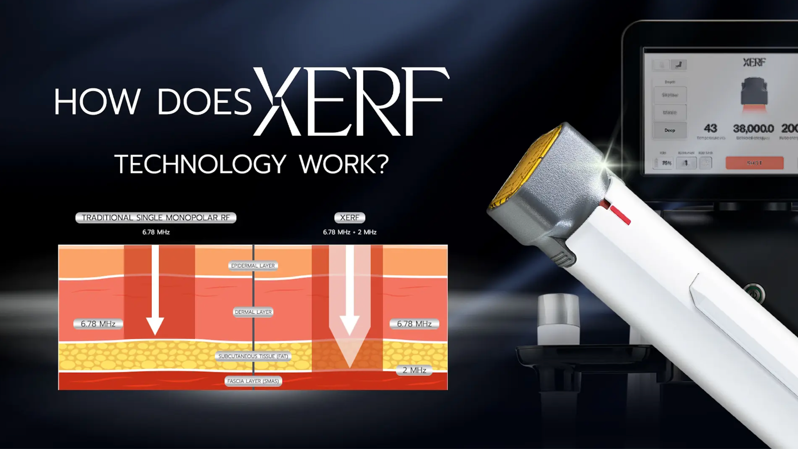 Diagram comparing traditional single-frequency monopolar RF (6.78 MHz) to XERF dual-frequency monopolar RF (6.78 MHz + 2 MHz) reaching deeper into the dermis and subcutaneous tissue.
